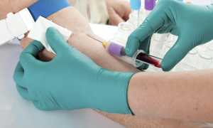 prelievosangue