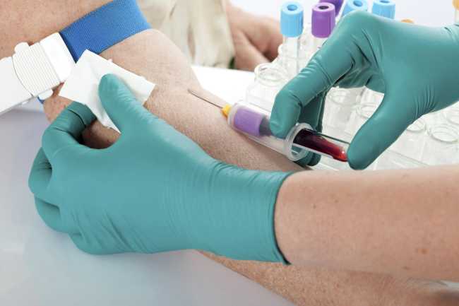 prelievosangue